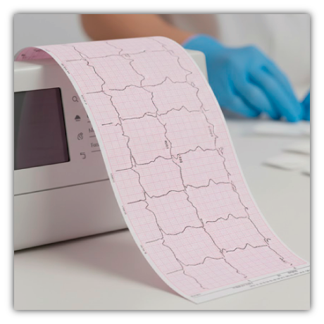 Ekg